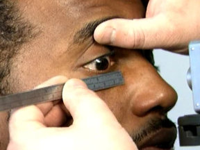 Глазной протез из силикона: слепок и форма