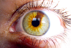 Гетерохромия – глаза разного цвета